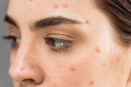 Проблеми - SKINLIST.UA
